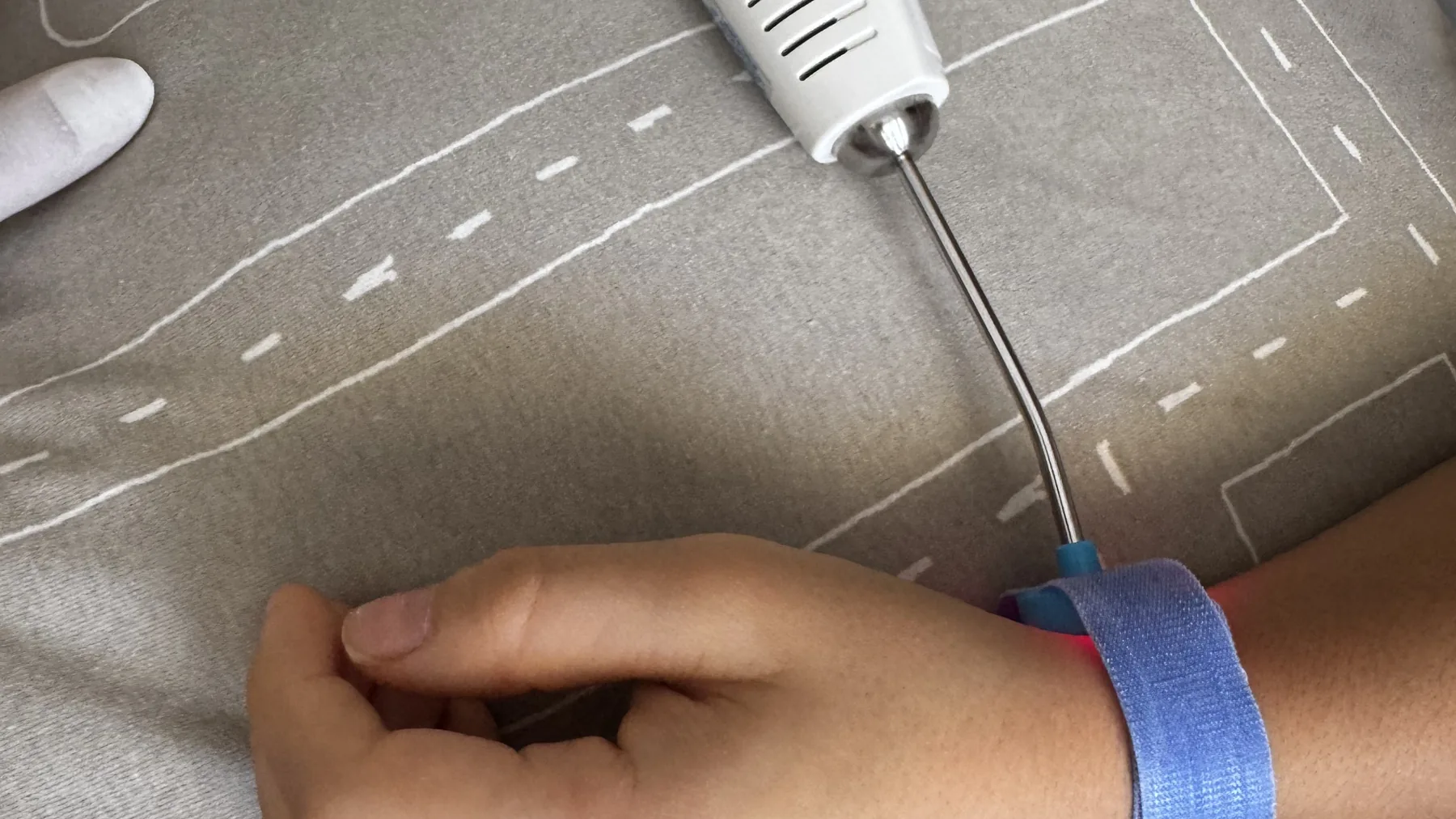 Aplicação de laserterapia durante o tratamento de uma lesão