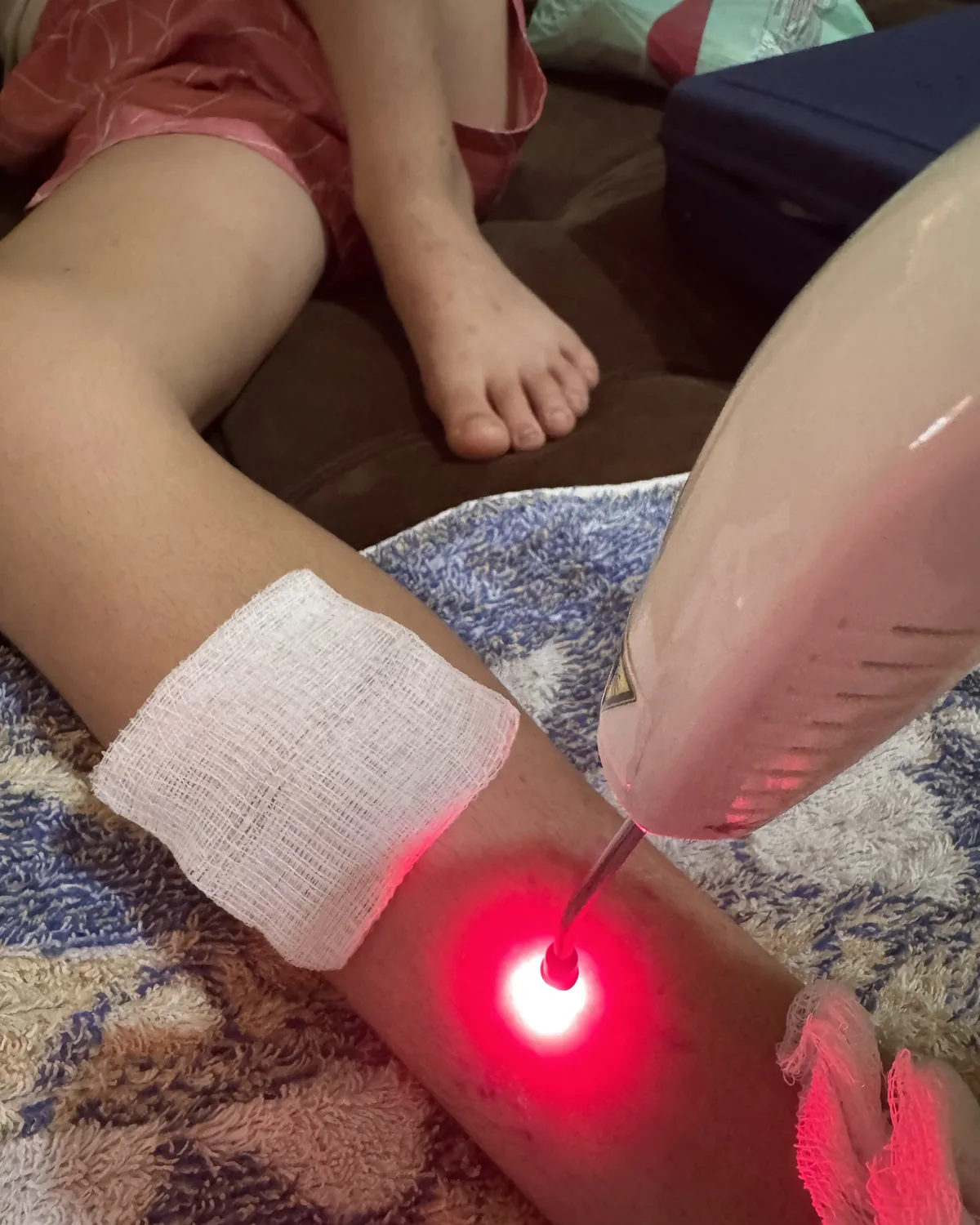 Sessão de laserterapia aplicada sobre lesão na região do tornozelo